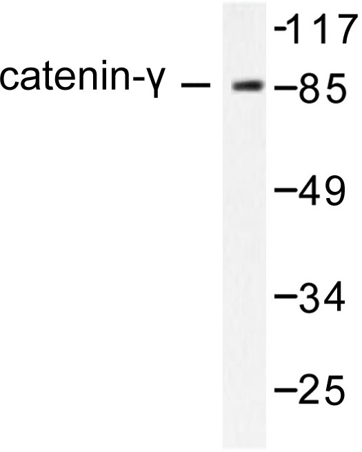 JUP/CTNNG/Junction Plakoglobin Antibody - Western blot of Catenin-/PLAK (731) pAb in extracts from HeLa cells.