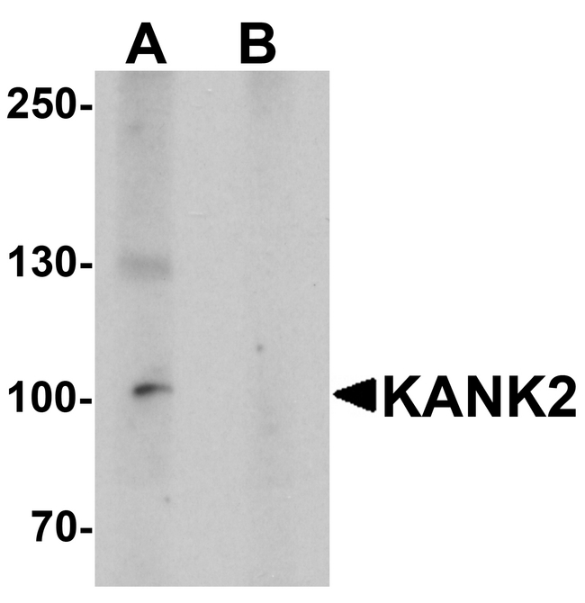 KANK2 Antibody - Western blot analysis of KANK2 in mouse brain tissue lysate with KANK2 antibody at 1 ug/ml in (A) the absence and (B) the presence of blocking peptide.