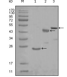 KARS Antibody - Western blot using KARS mouse monoclonal antibody against truncated Trx-KARS recombinant protein (1), truncated MBP-KARS (aa90-174) and full length KARS (aa1-188) transfected CHO-K1 cell lysate (3).