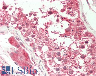 KAT5 / TIP60 Antibody - Human Testis: Formalin-Fixed, Paraffin-Embedded (FFPE).  This image was taken for the unconjugated form of this product. Other forms have not been tested.