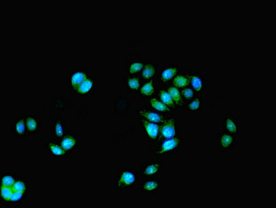 KAT5 / TIP60 Antibody - Immunofluorescent analysis of PC-3 cells using KAT5 Antibody at dilution of 1:100 and Alexa Fluor 488-congugated AffiniPure Goat Anti-Rabbit IgG(H+L)