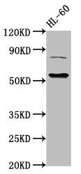 KAT5 / TIP60 Antibody - Western Blot Positive WB detected in: HL60 whole cell lysate All lanes: KAT5 antibody at 3µg/ml Secondary Goat polyclonal to rabbit IgG at 1/50000 dilution Predicted band size: 59, 54, 62, 57 kDa Observed band size: 59 kDa