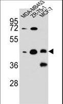 KBTBD13 Antibody - hCG_1645727 Antibody western blot of MDA-MB453,ZR-75-1,MCF-7 cell line lysates (35 ug/lane). The hCG_1645727 antibody detected the hCG_1645727 protein (arrow).
