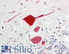 KCNC1 / Kv3.1 Antibody - Human Brain, Cerebellum: Formalin-Fixed, Paraffin-Embedded (FFPE)