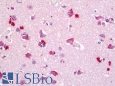 KCNC4 / Kv3.4 Antibody - Anti-KCNC4 / Kv3.4 antibody IHC staining of human brain, cortex. Immunohistochemistry of formalin-fixed, paraffin-embedded tissue after heat-induced antigen retrieval. Antibody dilution 1:50.