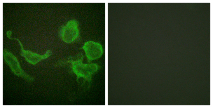KCNC4 / Kv3.4 Antibody - Immunofluorescence analysis of HeLa cells, using Kv3.4/KCNC4 Antibody. The picture on the right is blocked with the synthesized peptide.