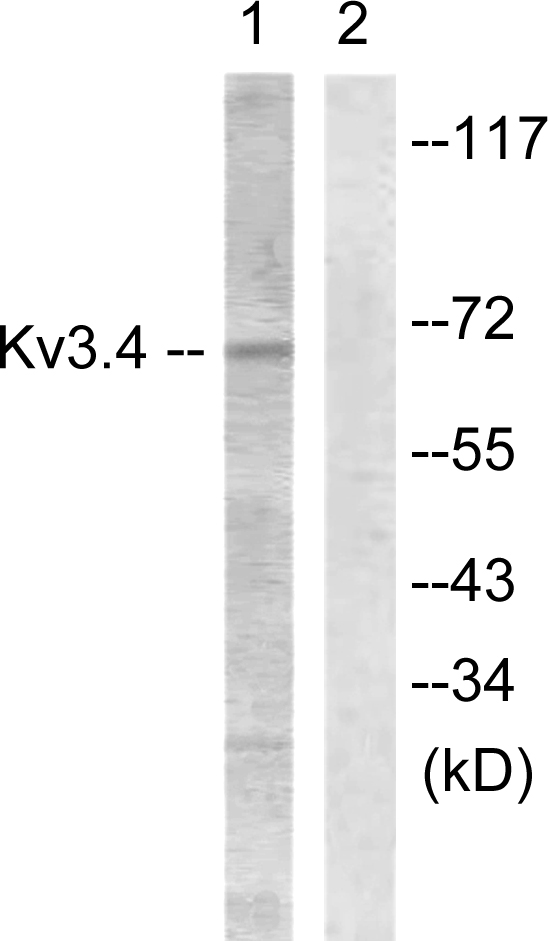 KCNC4 / Kv3.4 Antibody - Western blot analysis of lysates from COS7 cells treated with Anisomycin 25ug/ml 30', using Kv3.4/KCNC4 Antibody. The lane on the right is blocked with the synthesized peptide.