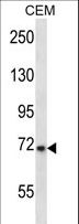 KCND3 / Kv4.3 Antibody - KCND3 Antibody western blot of CEM cell line lysates (35 ug/lane). The KCND3 antibody detected the KCND3 protein (arrow).