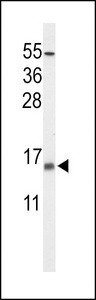 KCNE5 Antibody - Western blot of KCE1L Antibody in NCI-H460 cell line lysates (35 ug/lane). KCE1L (arrow) was detected using the purified antibody.