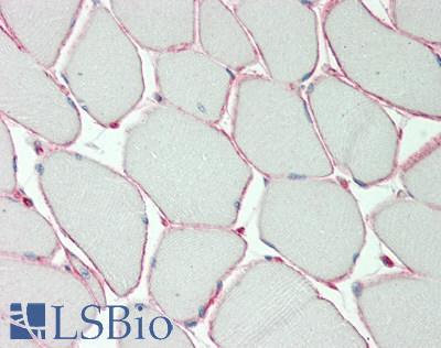 KCNE5 Antibody - Human Skeletal Muscle: Formalin-Fixed, Paraffin-Embedded (FFPE)