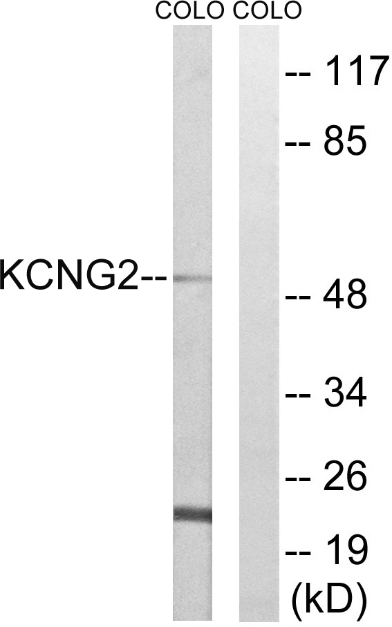 KCNG2 Antibody - Western blot analysis of lysates from COLO cells, using KCNG2 Antibody. The lane on the right is blocked with the synthesized peptide.