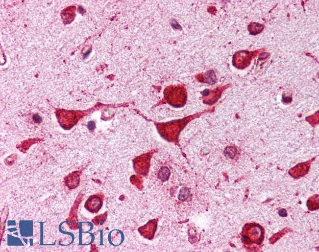 KCNIP3 / Dream / Calsenilin Antibody - Anti-KCNIP3 / CSEN antibody IHC of human brain, cortex. Immunohistochemistry of formalin-fixed, paraffin-embedded tissue after heat-induced antigen retrieval. Antibody concentration 5 ug/ml.