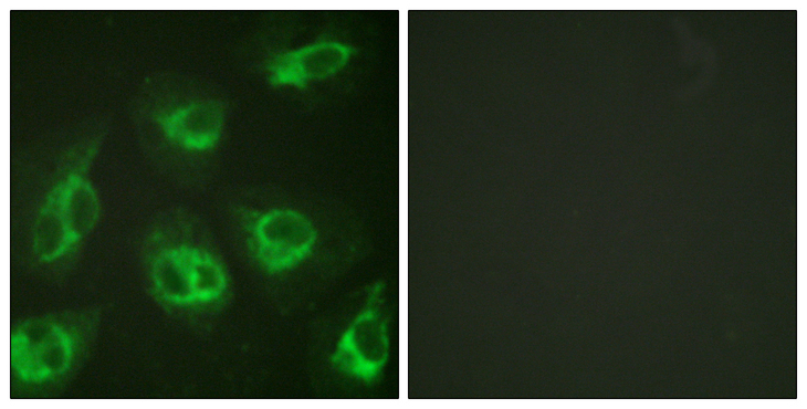 KCNIP3 / Dream / Calsenilin Antibody - Immunofluorescence analysis of HeLa cells, using Calsenilin/KCNIP3 Antibody. The picture on the right is blocked with the synthesized peptide.
