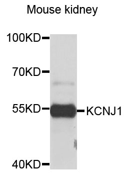 KCNJ1 / ROMK Antibody - Western blot analysis of extracts of mouse kidney cells.