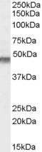 KCNJ11 / Kir6.2 Antibody - Antibody (0.1 ug/ml) staining of Human Muscle lysate (35 ug protein in RIPA buffer). Primary incubation was 1 hour. Detected by chemiluminescence.