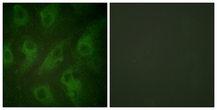 KCNJ11 / Kir6.2 Antibody - Immunofluorescence analysis of HeLa cells, using Kir6.2 Antibody. The picture on the right is blocked with the synthesized peptide.