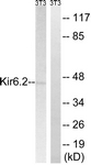 KCNJ11 / Kir6.2 Antibody - Western blot of extracts from 3T3 cells, using Kir6.2 Antibody. The lane on the right is treated with the synthesized peptide.