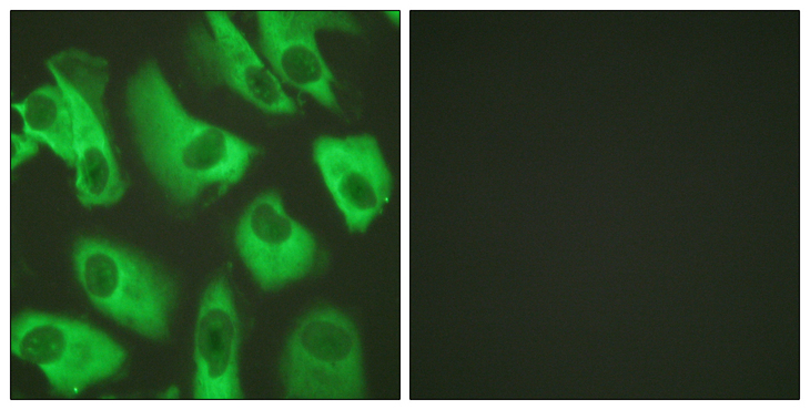 KCNJ16 / Kir5.1 Antibody - Immunofluorescence analysis of HeLa cells, using Kir5.1 Antibody. The picture on the right is blocked with the synthesized peptide.
