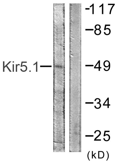 KCNJ16 / Kir5.1 Antibody - Western blot analysis of lysates from HeLa cells, using Kir5.1 Antibody. The lane on the right is blocked with the synthesized peptide.