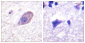 KCNJ16 / Kir5.1 Antibody - IHC of paraffin-embedded human brain tissue, using Kir5.1 Antibody. The picture on the right is treated with the synthesized peptide.