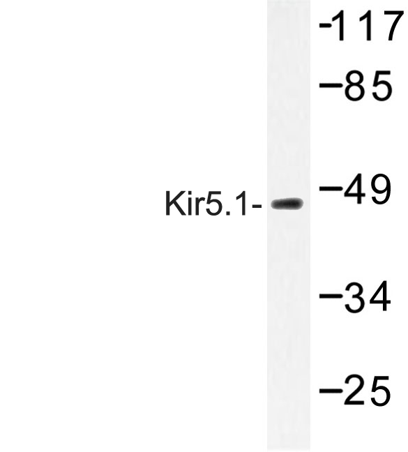 KCNJ16 / Kir5.1 Antibody - Western blot of Kir5.1 (N410) pAb in extracts from HeLa cells.