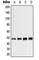 KCNJ5 / Kir3.4 / GIRK4 Antibody - Western blot analysis of Kir3.4 expression in MCF7 (A); Jurkat (B); Raw264.7 (C); PC12 (D) whole cell lysates.