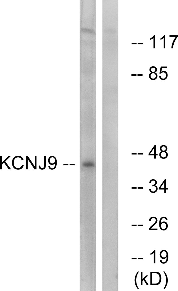 KCNJ9 / Kir3.3 / GIRK3 Antibody - Western blot analysis of lysates from LOVO cells, using KCNJ9 Antibody. The lane on the right is blocked with the synthesized peptide.