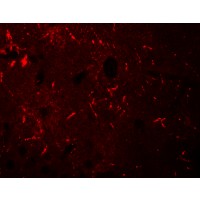 KCNK12 Antibody - Immunofluorescence of KCNK12 in mouse brain tissue with KCNK12 antibody at 20 µg/mL.