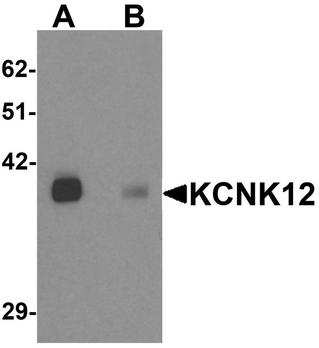 KCNK12 Antibody - Western blot analysis of KCNK12 in rat brain tissue lysate with KCNK12 antibody at 0.5 ug/ml in (A) the absence and (B) the presence of blocking peptide.