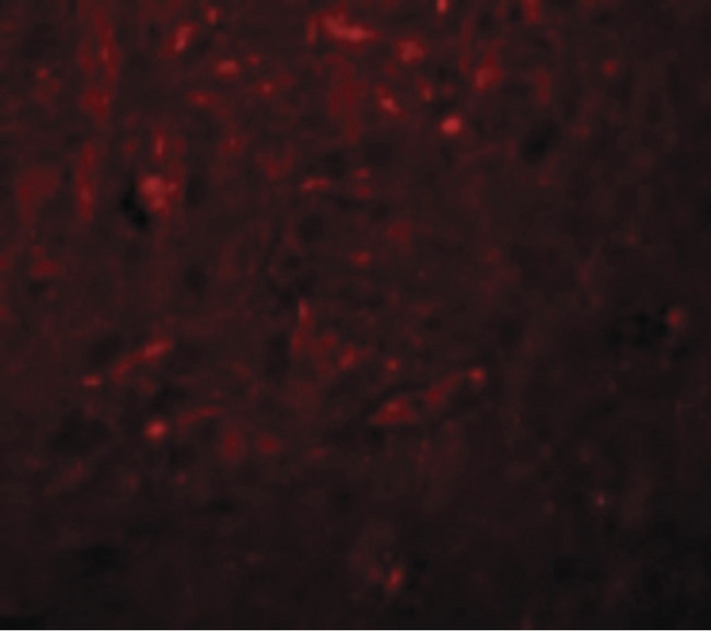 KCNK18 / TRESK Antibody - Immunofluorescence of TRESK in Rat Brain cells with TRESK antibody at 20 ug/ml.