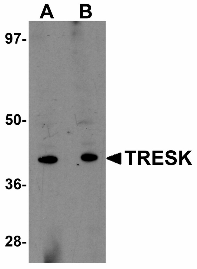KCNK18 / TRESK Antibody - Western blot of TRESK in rat brain tissue lysate with TRESK antibody at (A) 1 and (B) 2 ug/ml.