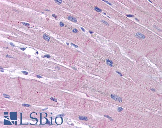 KCNK18 / TRESK Antibody - Anti-KCNK18 / TRESK antibody IHC of human heart. Immunohistochemistry of formalin-fixed, paraffin-embedded tissue after heat-induced antigen retrieval. Antibody concentration 5 ug/ml.