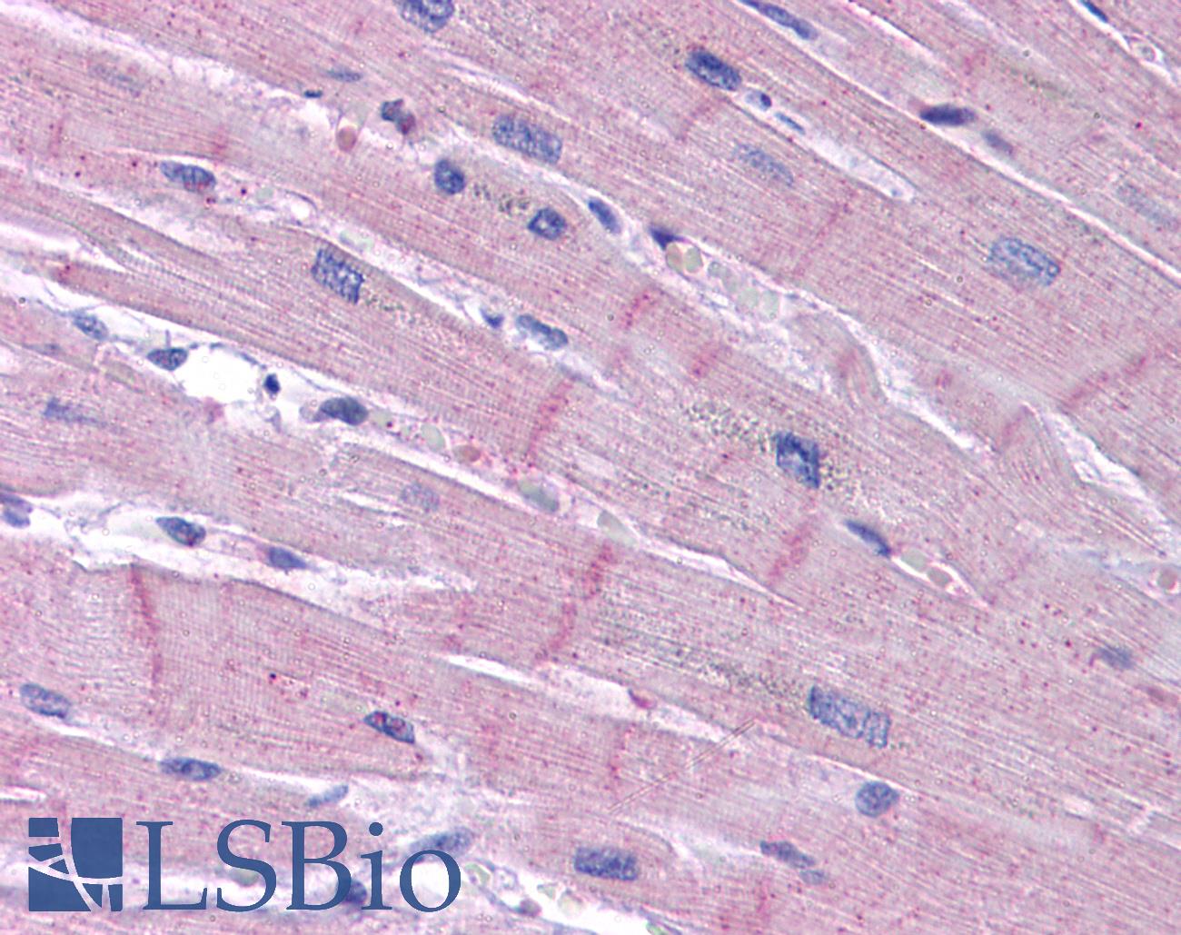 KCNK18 / TRESK Antibody - Anti-KCNK18 / TRESK antibody IHC of human heart. Immunohistochemistry of formalin-fixed, paraffin-embedded tissue after heat-induced antigen retrieval. Antibody concentration 5 ug/ml.
