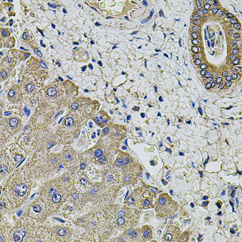 KCNK9 / TASK3 Antibody - Immunohistochemistry of paraffin-embedded human liver injury tissue.