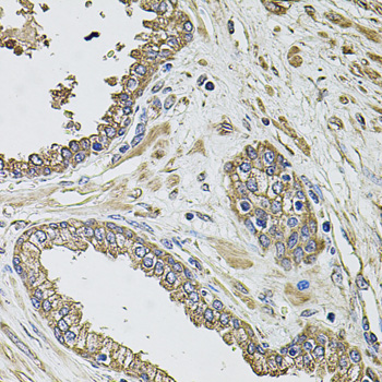 KCNK9 / TASK3 Antibody - Immunohistochemistry of paraffin-embedded human prostate tissue.