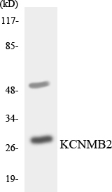 KCNMB2 Antibody - Western blot analysis of the lysates from HepG2 cells using KCNMB2 antibody.