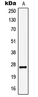 KCNMB2 Antibody - Western blot analysis of KCNMB2 expression in HepG2 (A) whole cell lysates.
