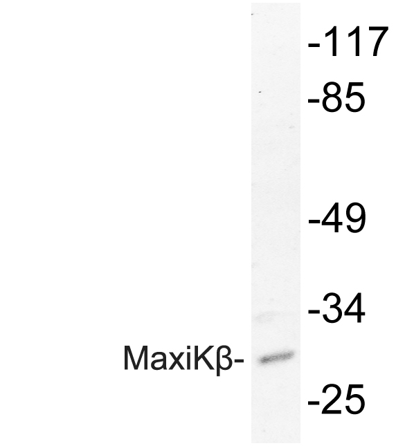 KCNMB4 Antibody - Western blot of MaxiK (K119) pAb in extracts from HepG2 cells.