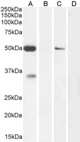 KCNN4 / KCa3.1 Antibody - Goat Anti-KCNN4 Antibody (0.1µg/ml) staining of Human Cerebellum (A) + Peptide (B), NIH3T3 (C) and negative Control Adrenal Gland (D) lysate (35µg protein in RIPA buffer). Detected by chemiluminescencence.
