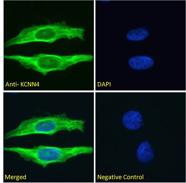 KCNN4 / KCa3.1 Antibody - Goat Anti-KCNN4 Antibody Immunofluorescence analysis of paraformaldehyde fixed HeLa cells, permeabilized with 0.15% Triton. Primary incubation 1hr (10ug/ml) followed by Alexa Fluor 488 secondary antibody (2ug/ml), showing membrane/cytoplasmic staining. The nuclear stain is DAPI (blue). Negative control: Unimmunized goat IgG (10ug/ml) followed by Alexa Fluor 488 secondary antibody (2ug/ml).