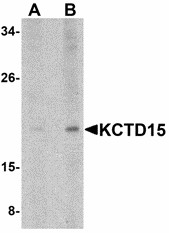 KCTD15 Antibody - Western blot of KCTD15 in human spleen tissue lysate with KCTD15 antibody at (A) 0.5 and (B) 1 ug/ml. 