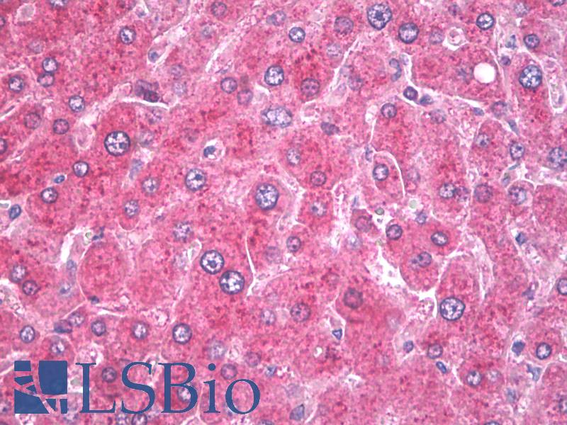 KDELR / KDEL Receptor Antibody - Anti-KDEL Receptor antibody IHC of human liver. Immunohistochemistry of formalin-fixed, paraffin-embedded tissue after heat-induced antigen retrieval. Antibody dilution 10 ug/ml.  This image was taken for the unconjugated form of this product. Other forms have not been tested.