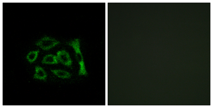 KDELR2 Antibody - Immunofluorescence analysis of A549 cells, using ERD22 Antibody. The picture on the right is blocked with the synthesized peptide.
