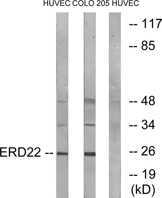 KDELR2 Antibody - Western blot analysis of lysates from HUVEC and COLO cells, using ERD22 Antibody. The lane on the right is blocked with the synthesized peptide.