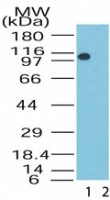 KDM1A / LSD1 Antibody - Western blot of LSD1 in the 1) absence and 2) presence of immunizing peptide in human brain lysate using antibody at 0.5 ug/ml.