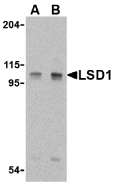 KDM1A / LSD1 Antibody - Western blot of P815 cell lysate with KDM1A (LSD1) antibody at (A) 1 and (B) 2 ug/ml.