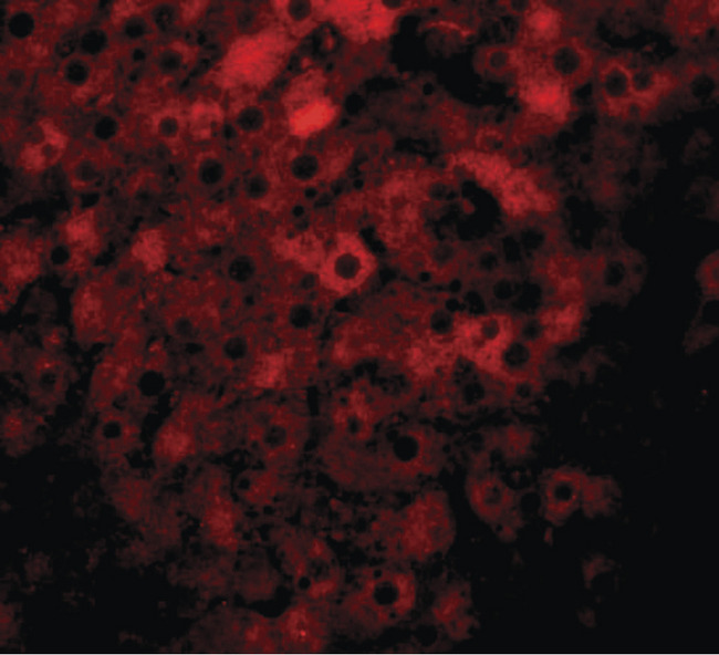 KDM3B / JMJD1B Antibody - Immunofluorescence of JMJD1B in rat liver tissue with JMJD1B antibody at 20 ug/ml.