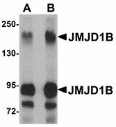 KDM3B / JMJD1B Antibody - Western blot of JMJD1B in rat liver tissue lysate with JMJD1B antibody at (A) 1 and (B) 2 ug/ml.