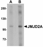 KDM4A / JHDM3A / JMJD2A Antibody - Western blot of JMJD2A in rat liver tissue lysate with JMJD2A antibody at (A) 1 and (B) 2 ug/ml.