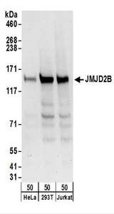 KDM4B / JMJD2B Antibody - Detection of Human JMJD2B by Western Blot. Samples: Whole cell lysate (50 ug) from HeLa, 293T, and Jurkat cells. Antibodies: Affinity purified rabbit anti-JMJD2B antibody used for WB at 0.1 ug/ml. Detection: Chemiluminescence with an exposure time of 30 seconds.